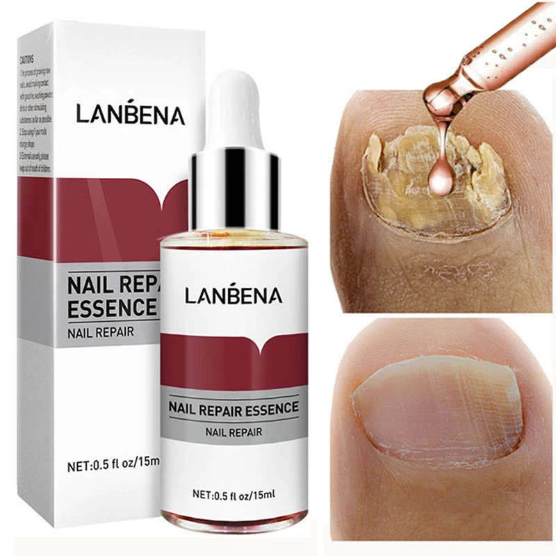 Nail Fungus Repair Liquid Anti Fungal Serum Remove Onychomycosis Softening Repairing Cracked