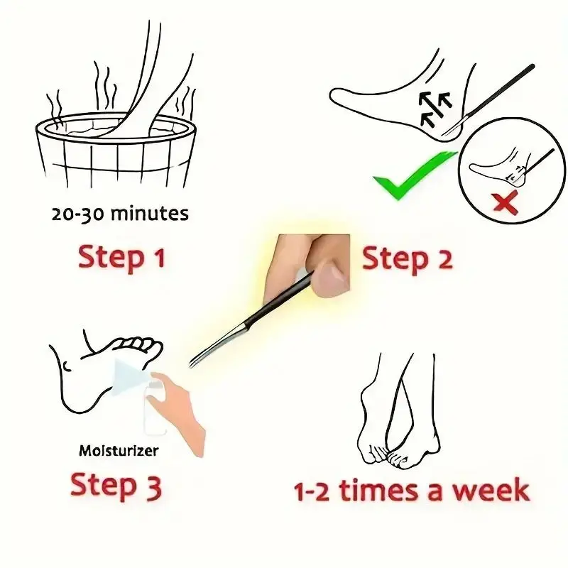 Stainless Steel Foot Knife Dead Skin Remover Toe Nail Shaver Callus Rasp for Pedicure Foot Care Shops