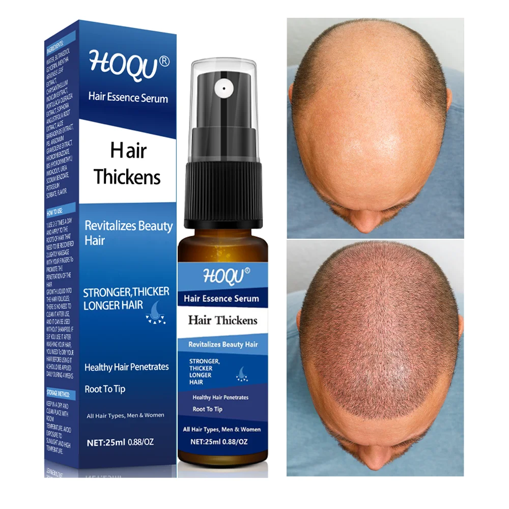 

Ginger Hair Spray Hair Growth Serum Anti Preventing Hair Loss Alopecia Liquid Damaged Hair Repair Growing Faster Men Women