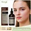 Face Dark Spot Remover Serum Reduce Pigmentation Brightening Dull Skin Tone Lighten Melanin Firming Moisturizing Repair Essence 1