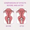 TENS/EMS Pelvic floor Muscle Stimulator Women Vaginal Trainer Kegel Exerciser Incontinence Sensation Tighten Dropshipping 2