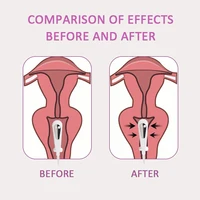 TENS/EMS Pelvic floor Muscle Stimulator Women Vaginal Trainer Kegel Exerciser Incontinence Sensation Tighten Dropshipping 2