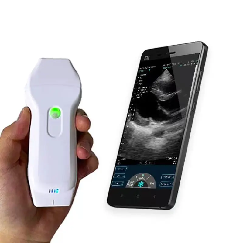 Color Ultrasound Doppler 3 in 1 Probe Convex Linear Phased Array Support iOS Android Windows Complimentary Suitcase