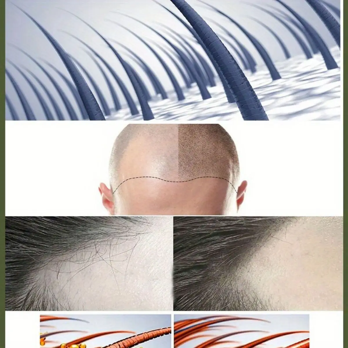 Hair Growth Serum for Men Essential Oil Hair Repair Furcation Protection Anti-hair Loss Beard