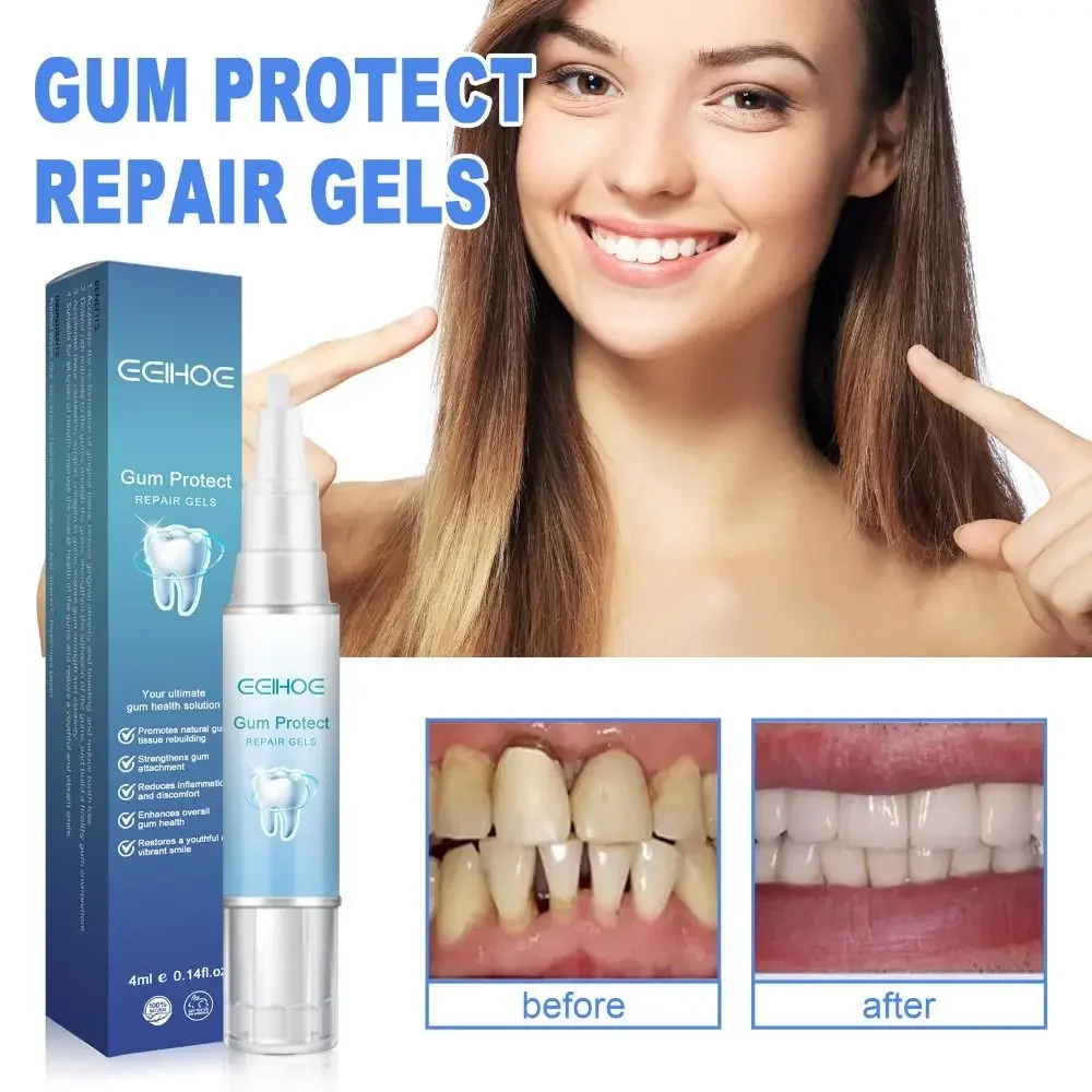 

Gum Treatment Gel Reduces Discomfort Dental Repair Gum Shield Therapy Gel Easy to Use Reduces Inflammation Oral Care