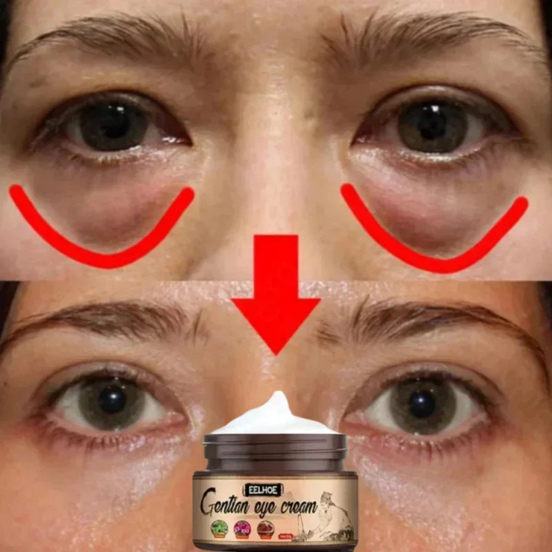 Instant Eye Bags Remove Eye Cream Anti Fat Particles Dark Circles Under-Eye Puffiness Firming Wrinkles Korean Skin Care Product