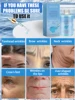 wrinkle free,20 years younger 3