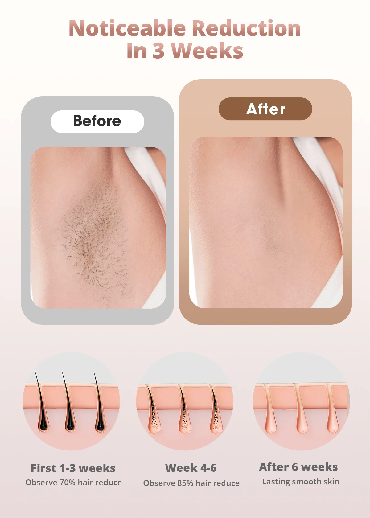 Laser Hair Removal - Cooling Painless IPL Hair Removal with Cleaning Lamp 9 Energy Levels for Women and Men Home Whole Body Use 2