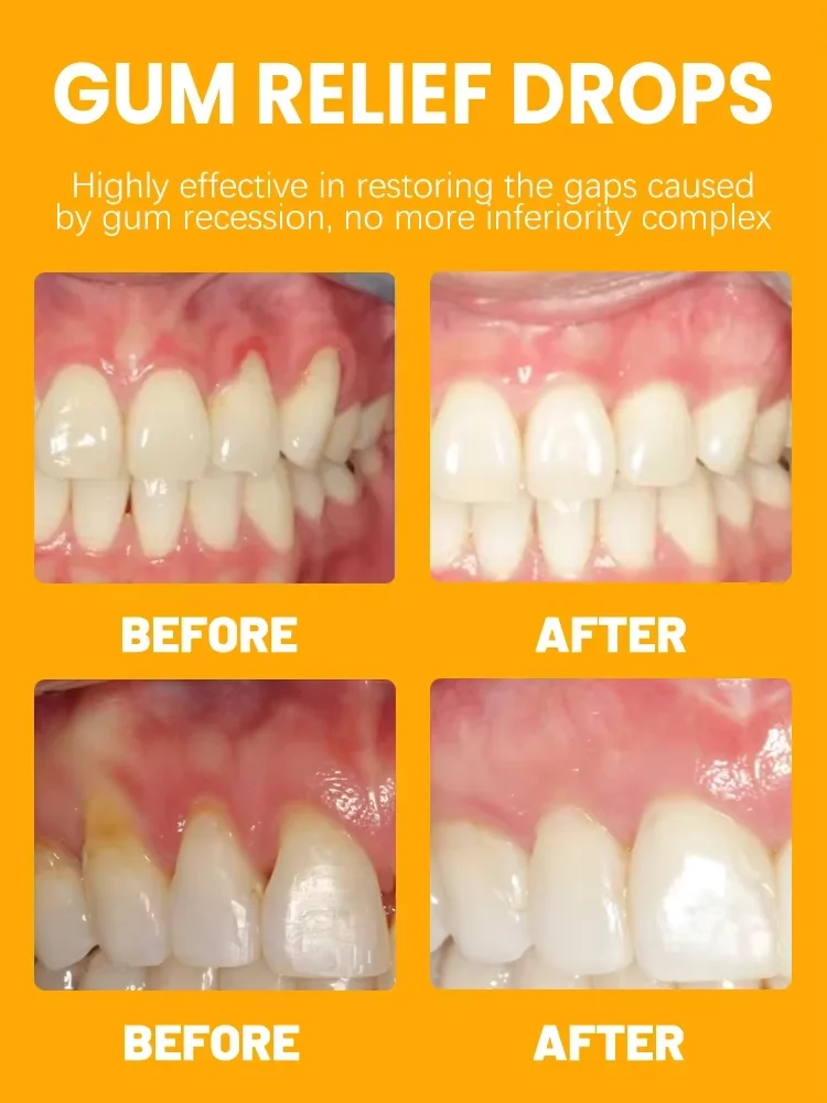 Rapid Repair Gums Serum Effectively Relieve Tooth Allergy Dental Caries Tooth Cleaning Toothpaste Relieve Damage Drops gum repair drops teeth health product