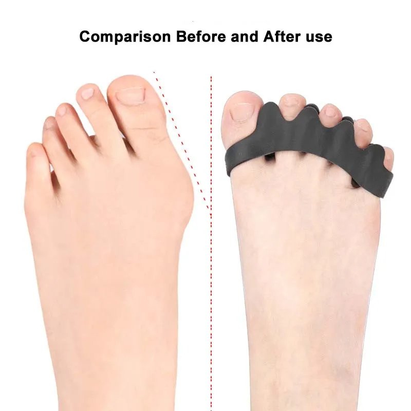 Ein Paar Zehenspreizer, Silikon-Trennung, fünf Löcher, Trennclip, Fuß- und Fingerschutz, Valgus-Zehenbereich, überlappender Zehenspreizer – Detail 5