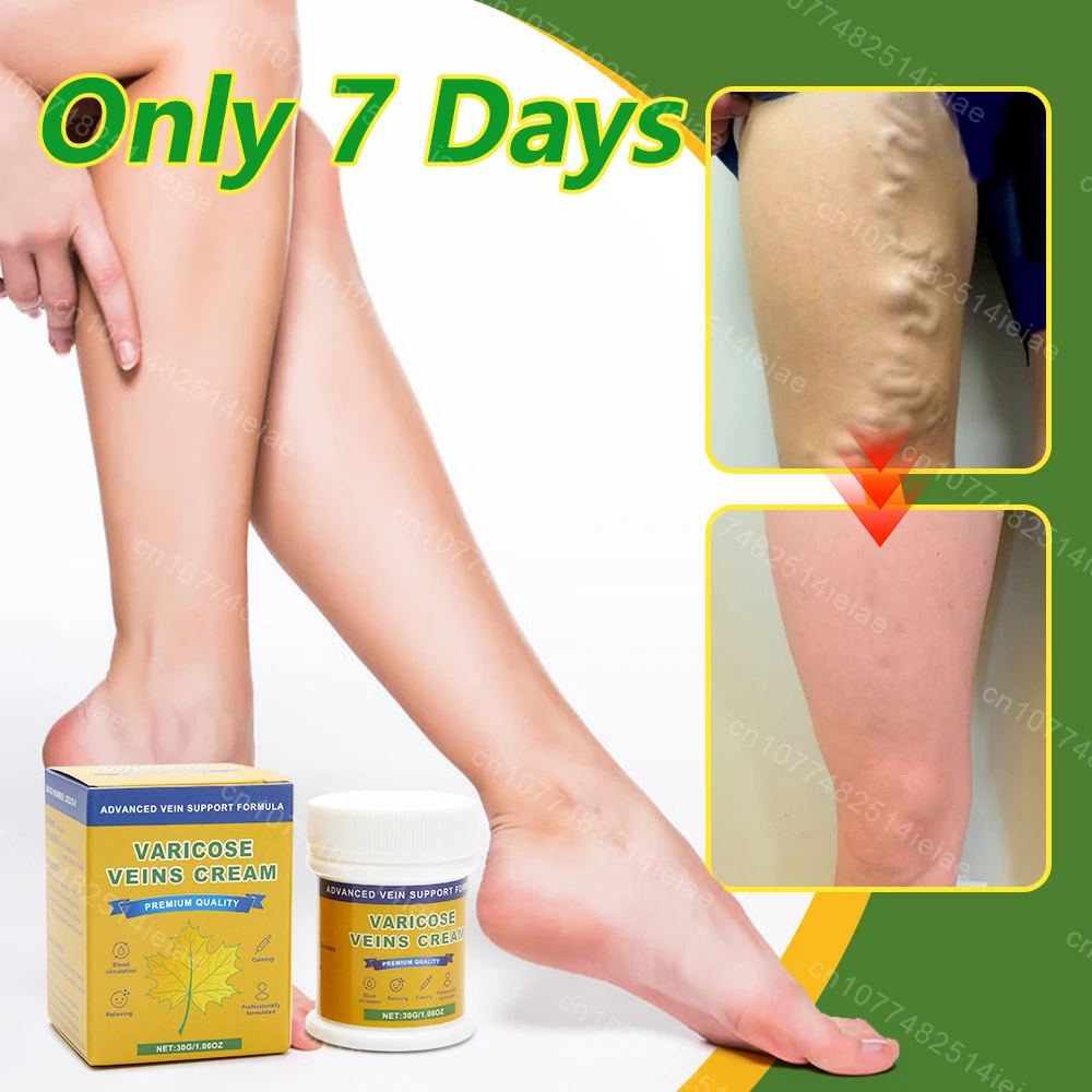 Improve Blood Circulation Varicose Veins Treatment Cream Fast-Acting Reduce Leg Swelling Wellness Cream Soothes Tired