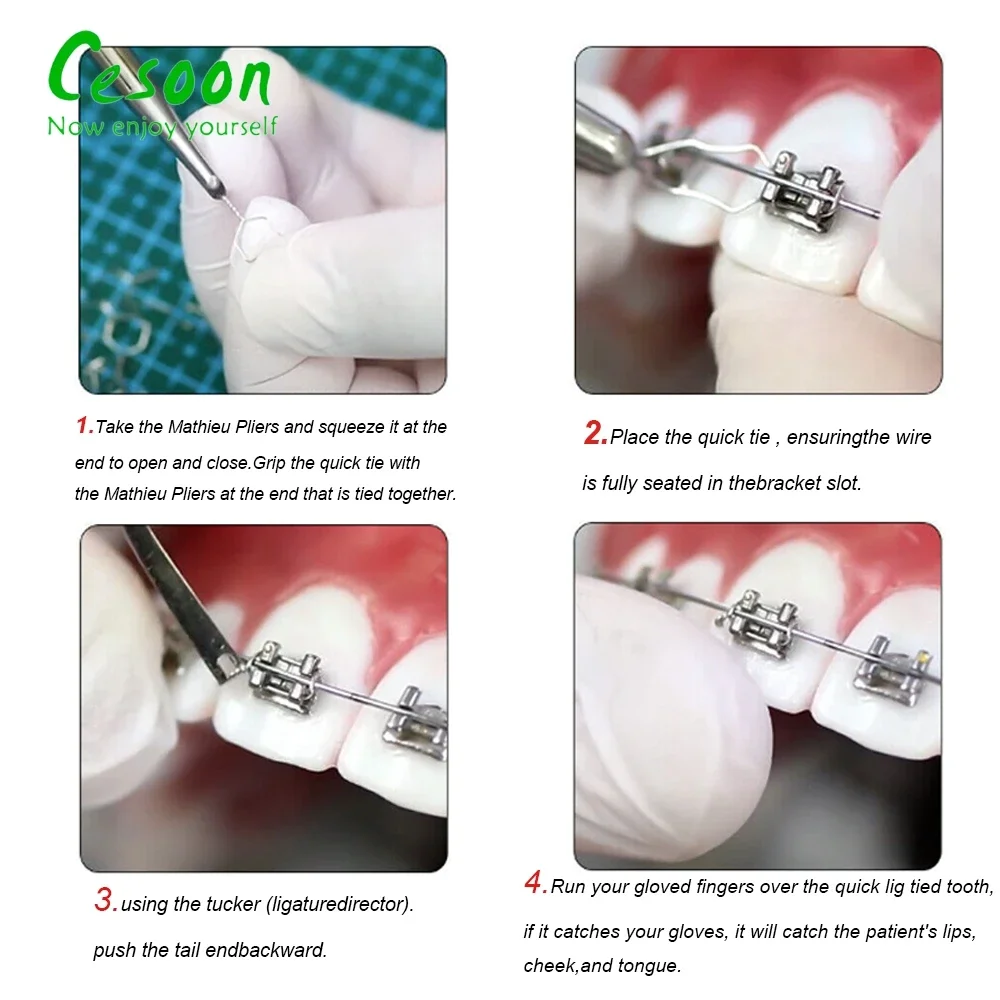 100pc Dental Orthodontic Wire Preformed Kobayashi Ligature Ties - Long & Short Twist