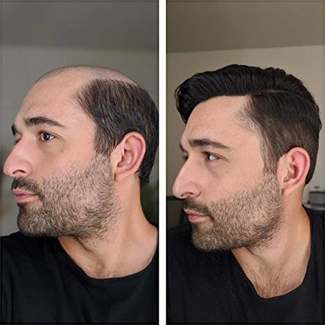 Tupé de pelo Natural para hombres, de cuero cabelludo simulado, pelucas masculinas, sistema de reemplazo de cabello _ AliExpress Mobile