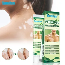 1Box Sumifun New Upgrade Vitiligo Care Cream Leukoplakia Repair Remove White Spot Ointment Antibacterial Skin Massage Plaster