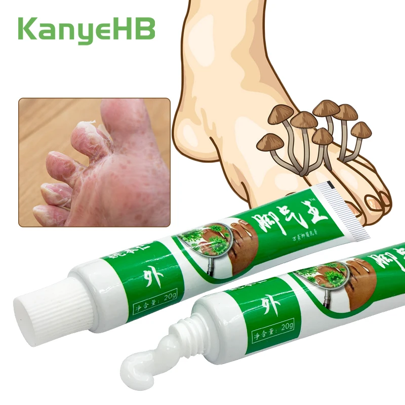 2Pcs Anti-fungal Foot Cream Herbal Athlete Foot Anti Itch Remove Corn Antibacterial for Feet Care A1066 antibacterial anti fungal cream