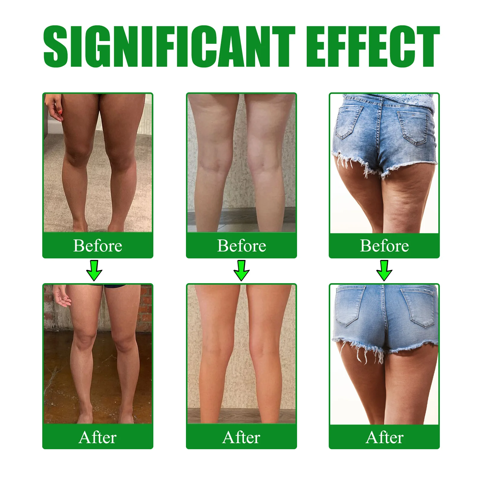 Leg Slimming Patch Thigh Shaping Tightening Firming Leg Muscle Anti Cellulite Promote Fat Burning Wormwood Lifting Sticker weight loss products