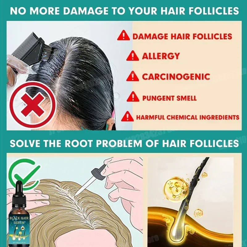 Natural Anti Gray Hair Serum-Repair White & Darkening Hair Nourishing Care Remedy