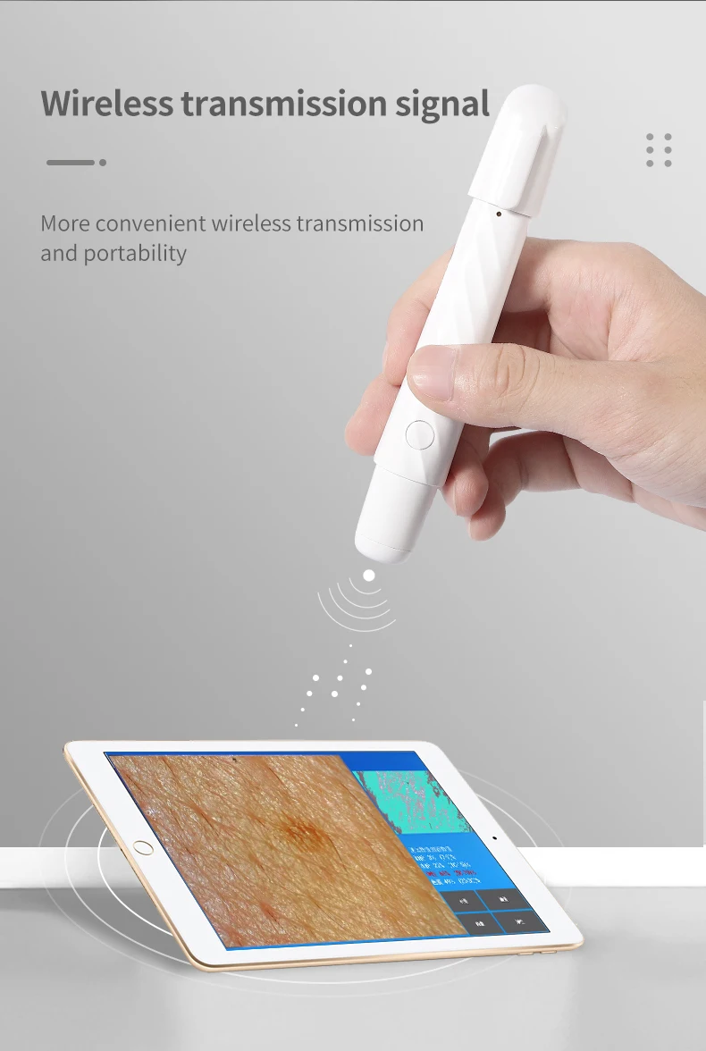 ڵ ޴   ī޶ ĳ,   , ȵ̵ IOS ý, Ǻ м, m80
