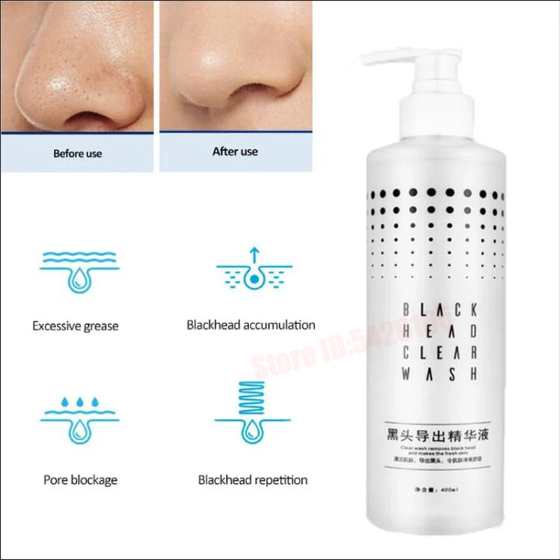 Nose Blackhead Peeling Solution Serum Facial Cleaning Liquid Scrub Special Solution Skin Deep Cleaning For Small Bubble 4