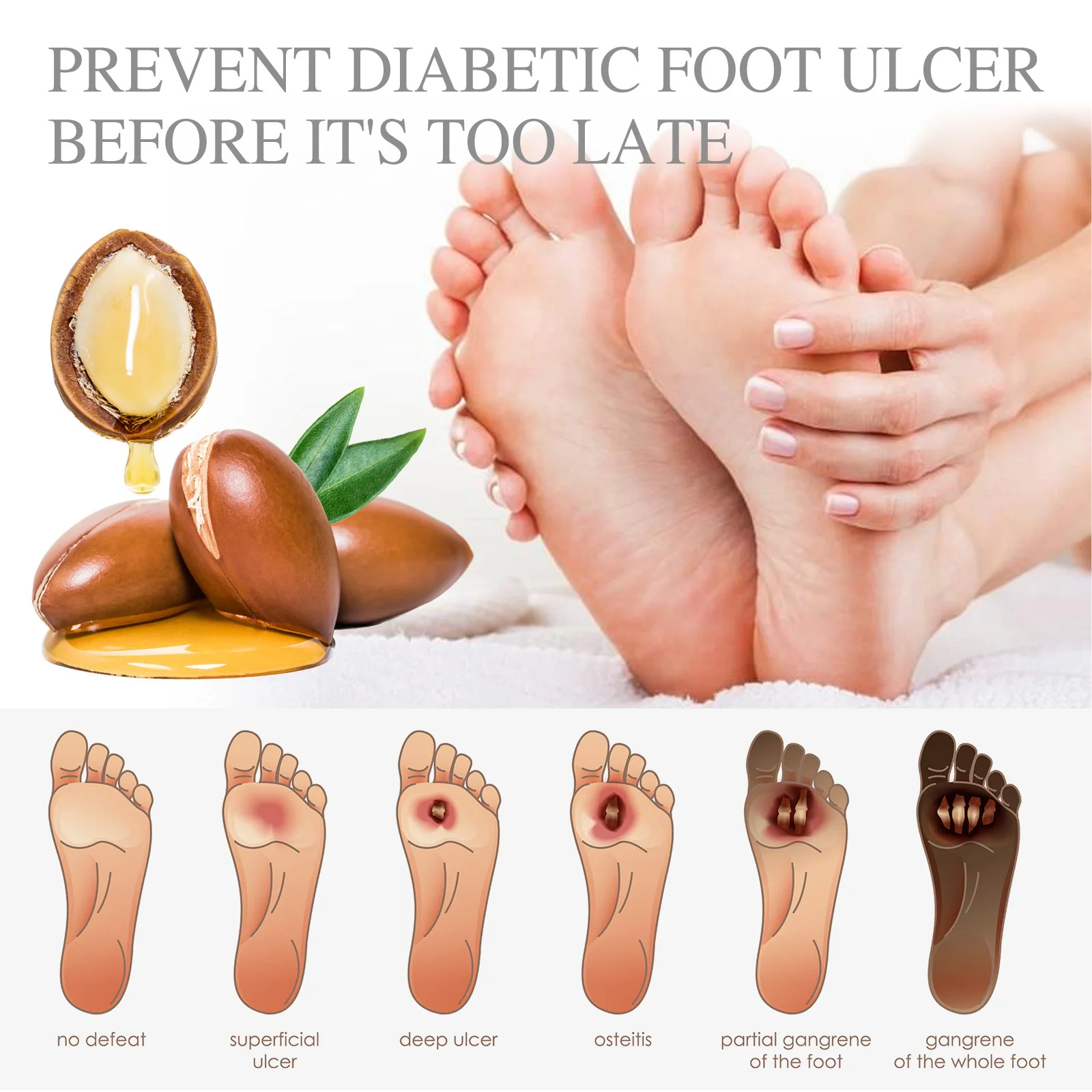 Diabetes Treatment Foot Cream Repair Feet Ulceration Relieve Itchy Improve Heel Cracking Nourishing Blood Sugar Care Ointment