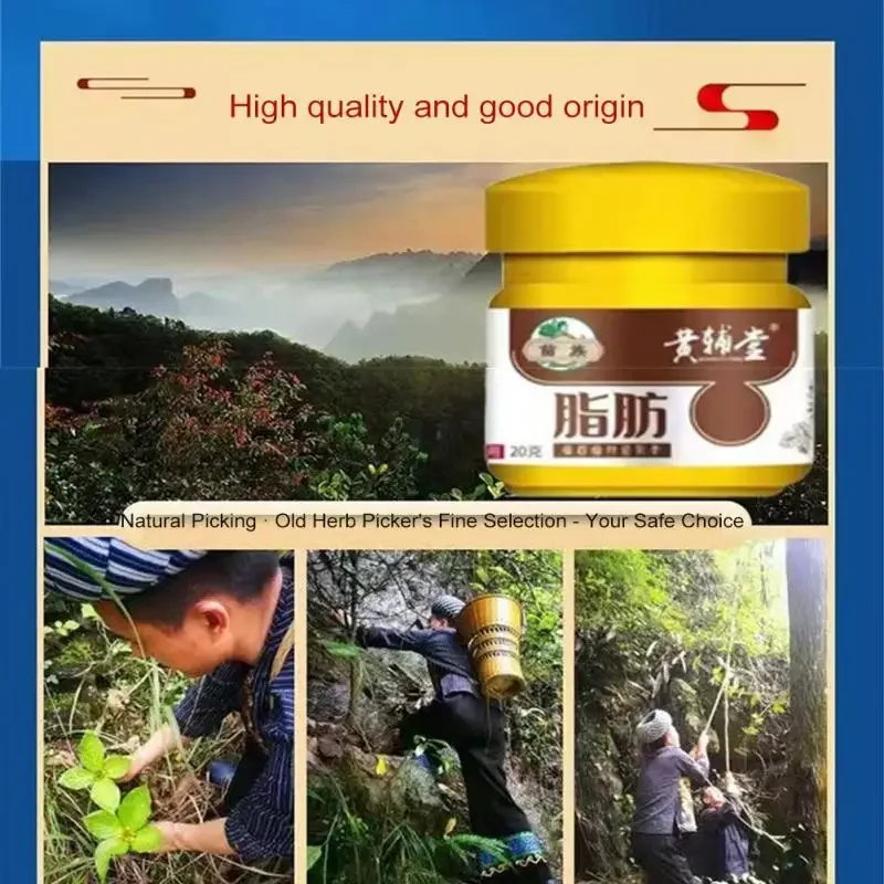 Lipoma Removal Cream 20g Relief Pain Treat Skin Swelling Lipolysis Cellulite Remover Ointment Lipolysis Fat Lump Body Care