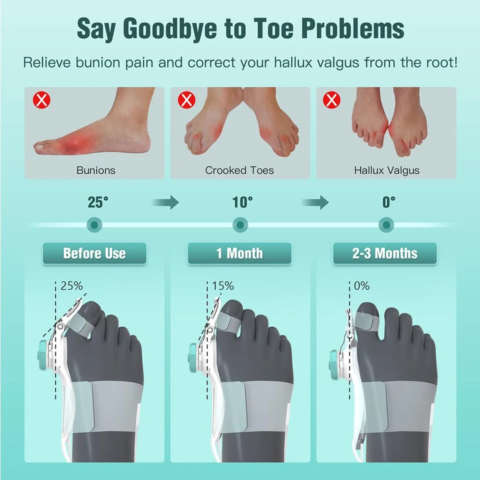 Bunion Hallux Valgu Big Valgus Rotatable Corrector Straightener Adjustable Toe Correction_voghion.com