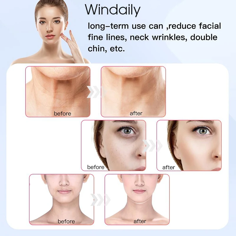 EMS Face Neck Lifting Device Vibration Facial Massager LED Light Therapy Machine Skin Tighten Wrinkle Remover Skin Care Tools