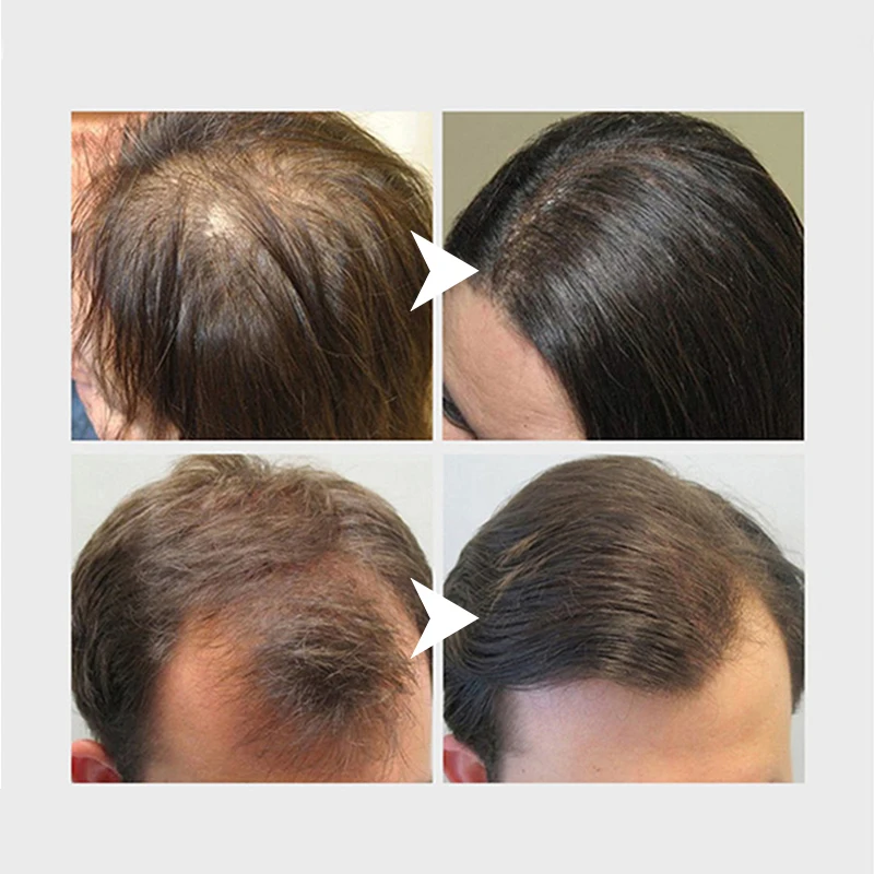 Rice Water Hair Growth Oil Natural Essentail Anti-Hair Loss Treatment Hair Hydrating Growth Nutrient Solution Care Products