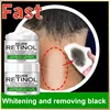 Body Whitening Cream Dark Skin Armpit Lightening Intimate Areas Underarm Bleaching Private Parts Whiten Cream Body Lotion Beauty 1