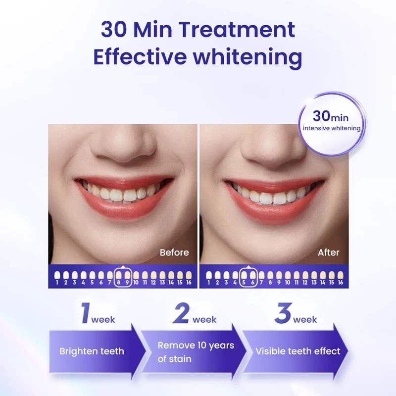 Crest 3D Whitestrips Professional White Teeth Whitening Fast White Teeth Strip Gentle Routine Glamorous Whitening Kit teeth whitening kit teeth whitening strips