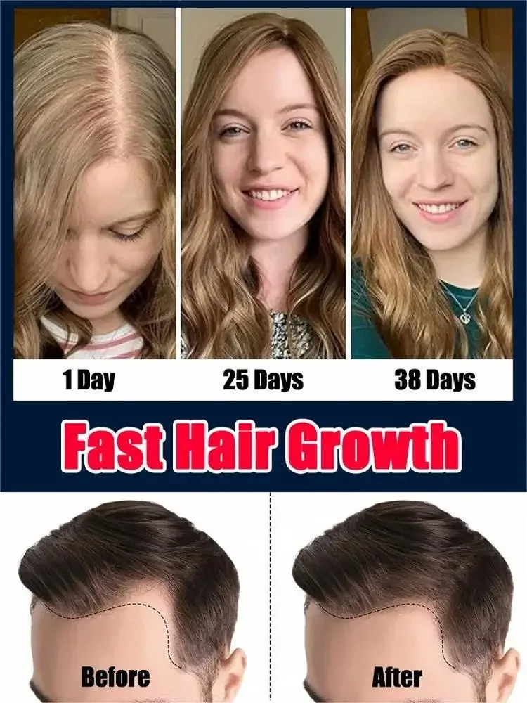Natural Hair Growth Oil Effective Hair Growth Products For Men Women Scalp Nourishing Care Loss Solution hair growth serum