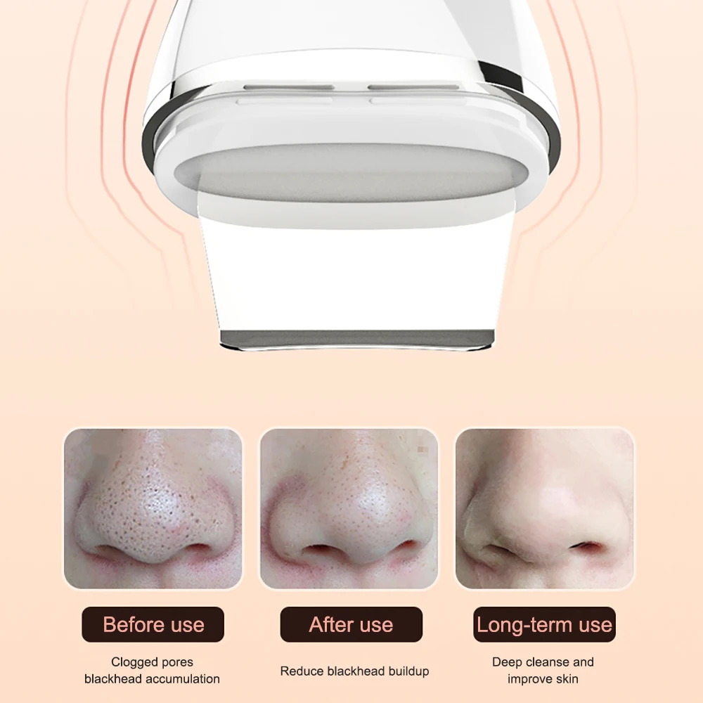 Ultrasonic Skin Scrubber Blackhead Remover Professional Face Cleaning Peeing Facial Cleaner Beauty Device