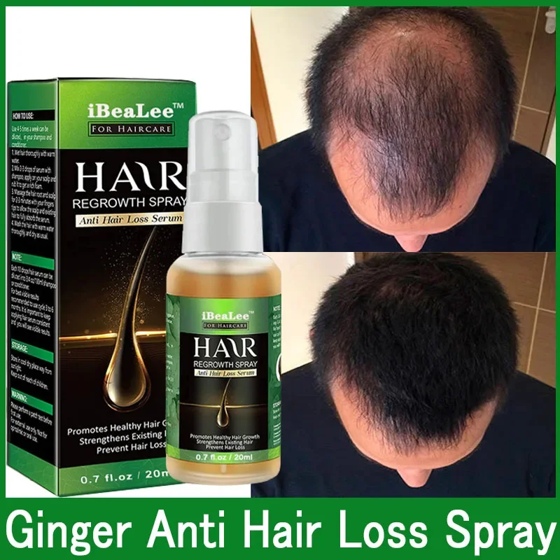 

Ginger Fast Hair Growth Spray Products Anti Hair Loss Serum Prevent Baldness Treatment Scalp Dry Damaged Hair Beauty Health Care