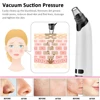 Hot Compress Electric Bubble Blackhead Remover Vacuum Suction Pore Cleaner Facial Tool Deep Clean Acne Pimple Care Extractor 4