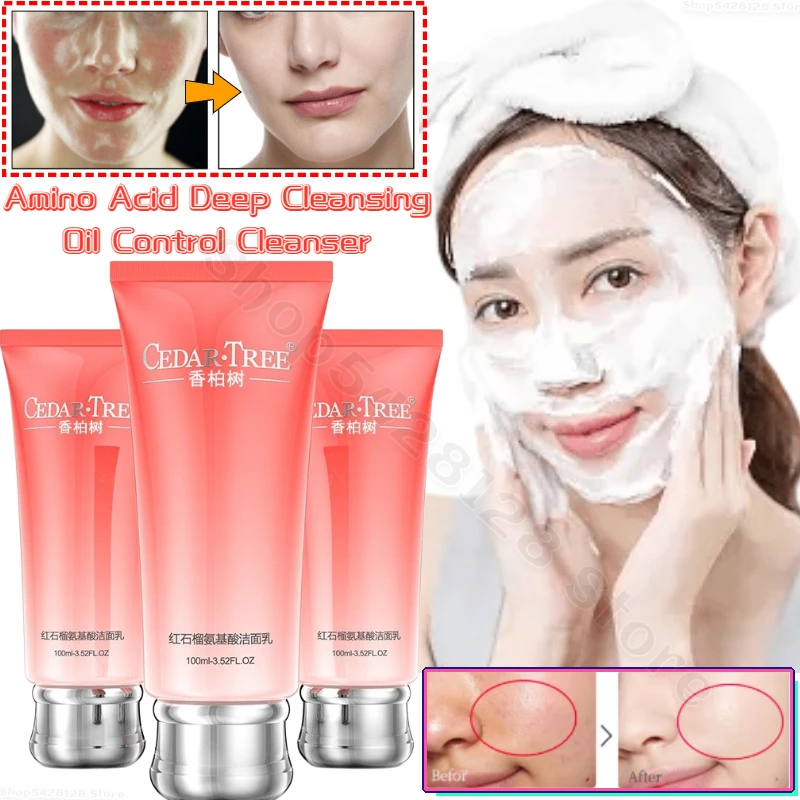 

Pomegranate Amino Acid Facial Cleanser Deep Cleansing Shrinks Pores Moisturizing Nourishing Brightening Skin Facial Cleanser