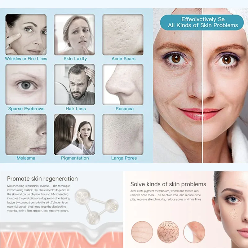 Рисунок 5 - Дерма-ручка Dermapen X6 Беспроводная