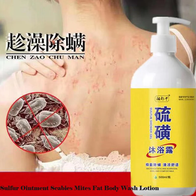 Effective Sulfur Ointment Scabies Mites Fat Bath Body Cream Sulphur Body Wash Lotion for Itching and Sterilization Whitening Body Lotion Body Wash