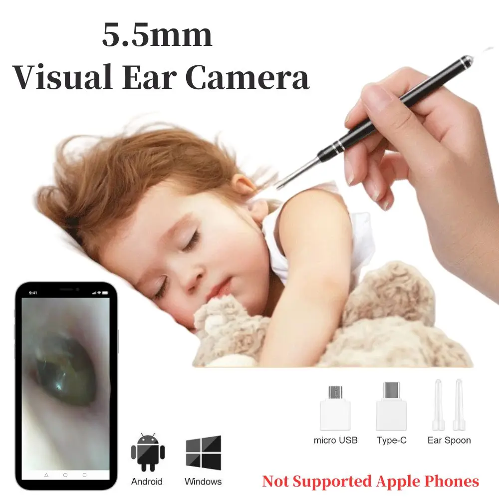 Mscopes For Usb Camera Webcam Android Mscopes Pro Ear Wax Removal