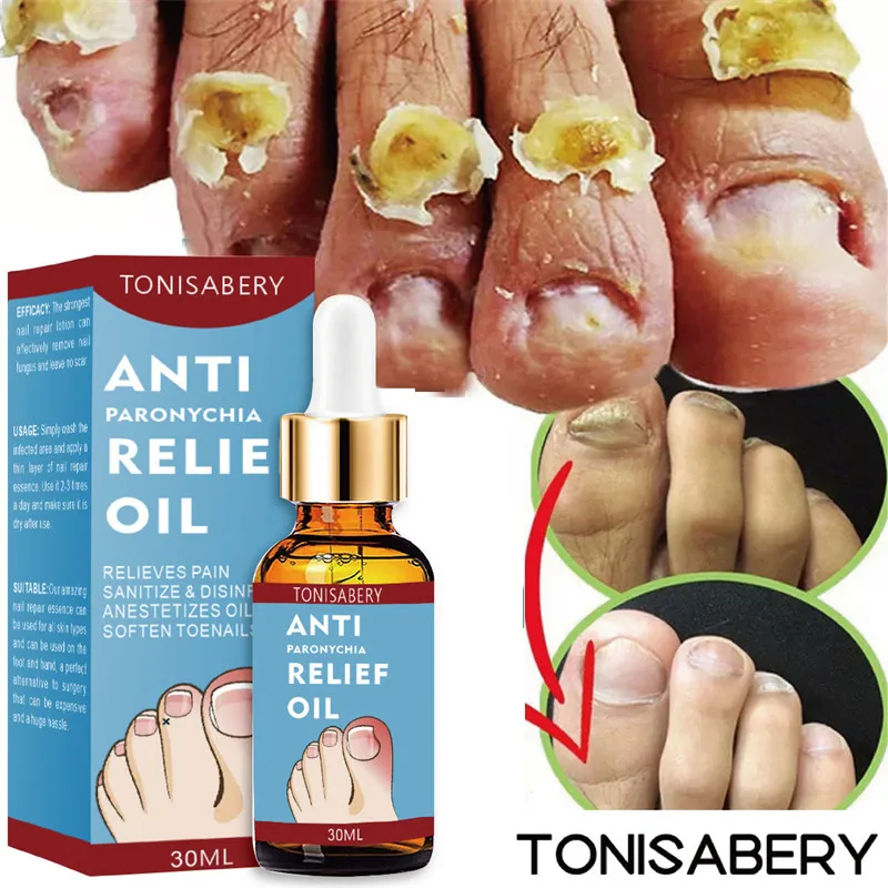 Nail Fungal Treatment Serum Oil Paronychia Anti Infection Toe Fungus