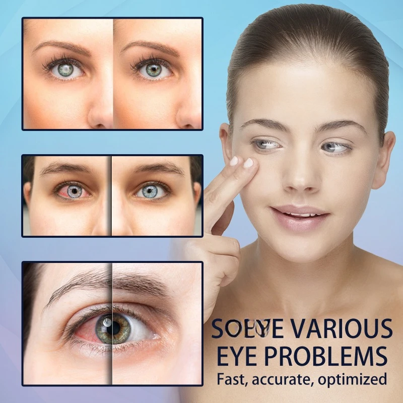 Eye Care Drops Eye Care Drops Treatment redness Blurred Vision Improve Enhance Eyesight Relief Eye Fatigue Dry itch Sooth Eyesight