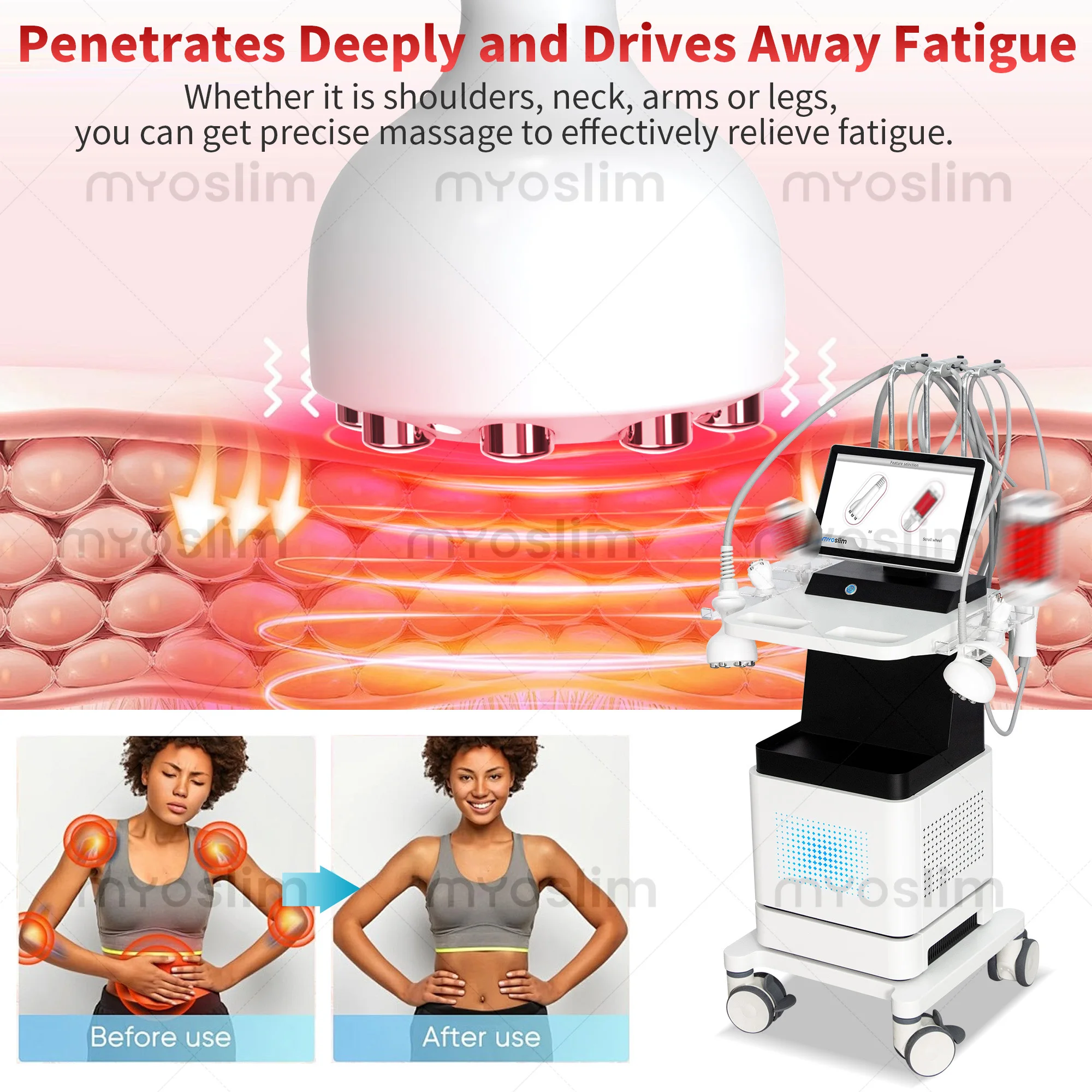 Máquina Venus Legacy 4D RF con Rodillo Interno para Moldear el Abdomen, Reafirmar la Piel, Reducir la Celulitis y Quemar Grasa Corporal