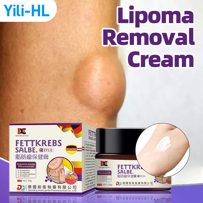 

Lipoma Removal Cream Fat Mass Remover For Lipomas Cyst Fat Lump Cellulite Fibroma Treatment Patch German Secret Recipe Medicine