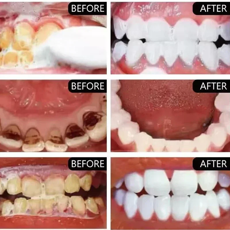 Polvere sbiancante per denti viola Rimuovi macchie di placca Pulizia Igiene orale Sbiancamento Strumenti dentali Alito fresco Illumina la cura dei denti - immagine 2