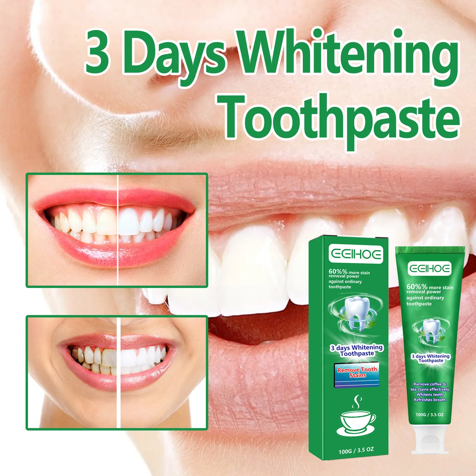 

Teeth Cleaning Effective Whitening Toothpaste Yellow Teeth Removing Plaque Tooth Stain Dental Cleansing Fresh Breath Care