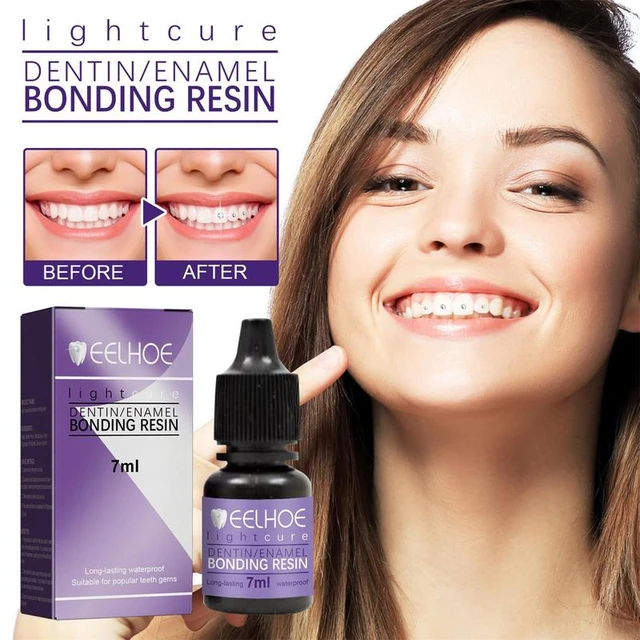 DIY Tooth Gem Glue Teeth Stone Cure Adhesive Bonding Agent Glue UV