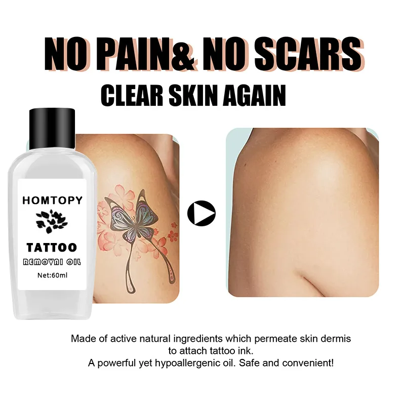 14 Things No One Tells You About Tattoo Removal | Glamour