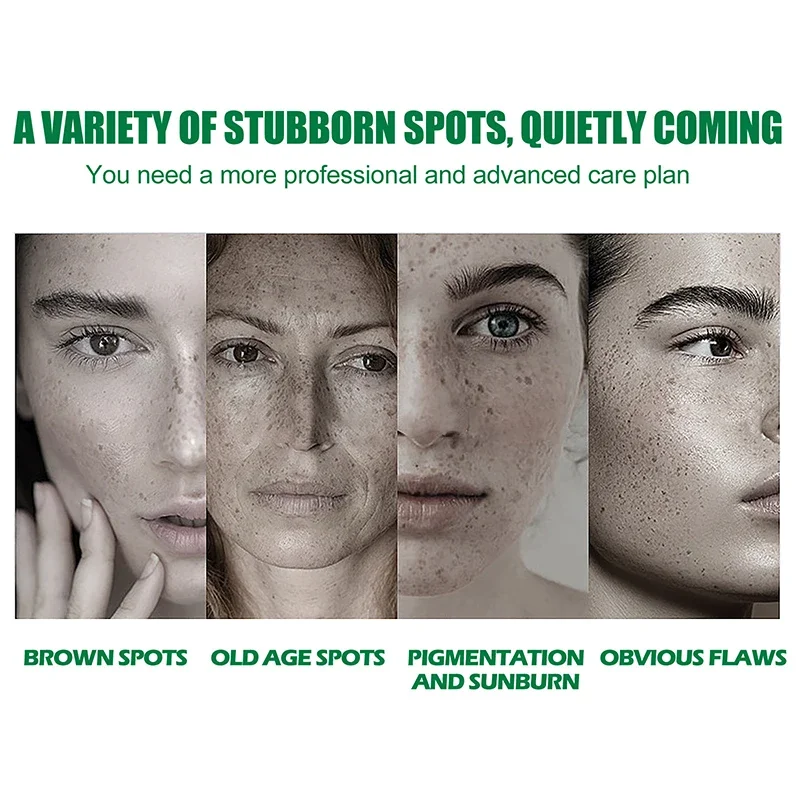 Facial Serum Dark Spot Correcting Glow Moisturizing Brightening Whitening Cream Reduce Freckles Dullness Acne And Melanin