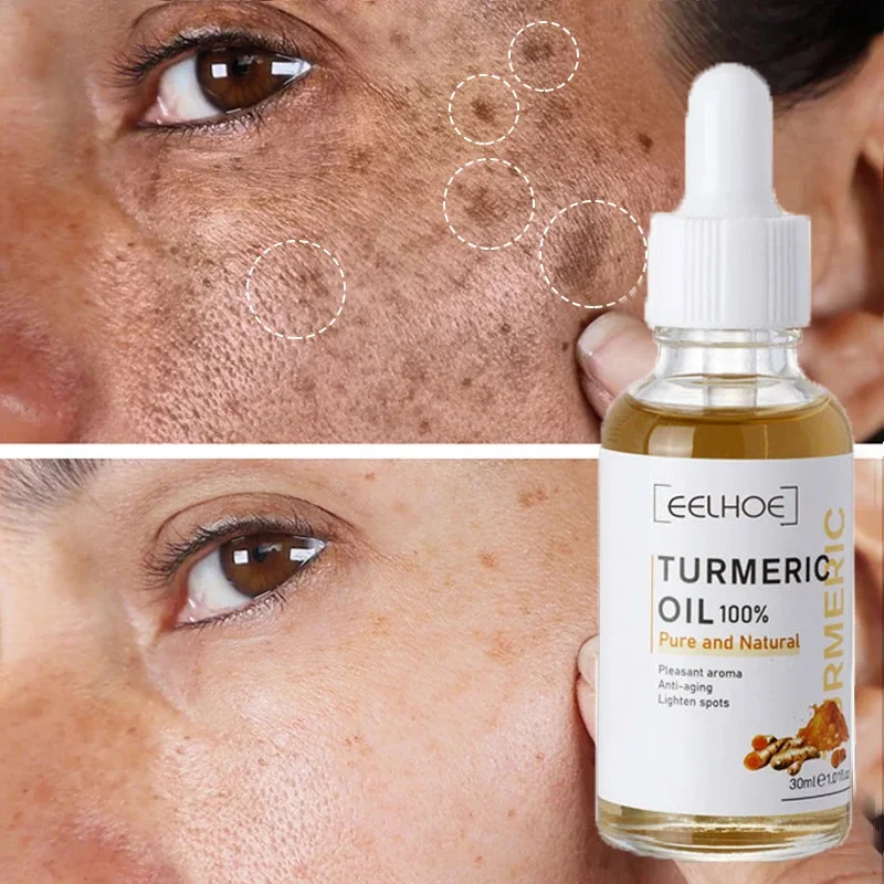 Turmeric Whitening Freckles Serum Remove Dark Spots Anti-aging Fade Fine  Lines Firming Moisturizing Improve Dull Face Skin Care - AliExpress