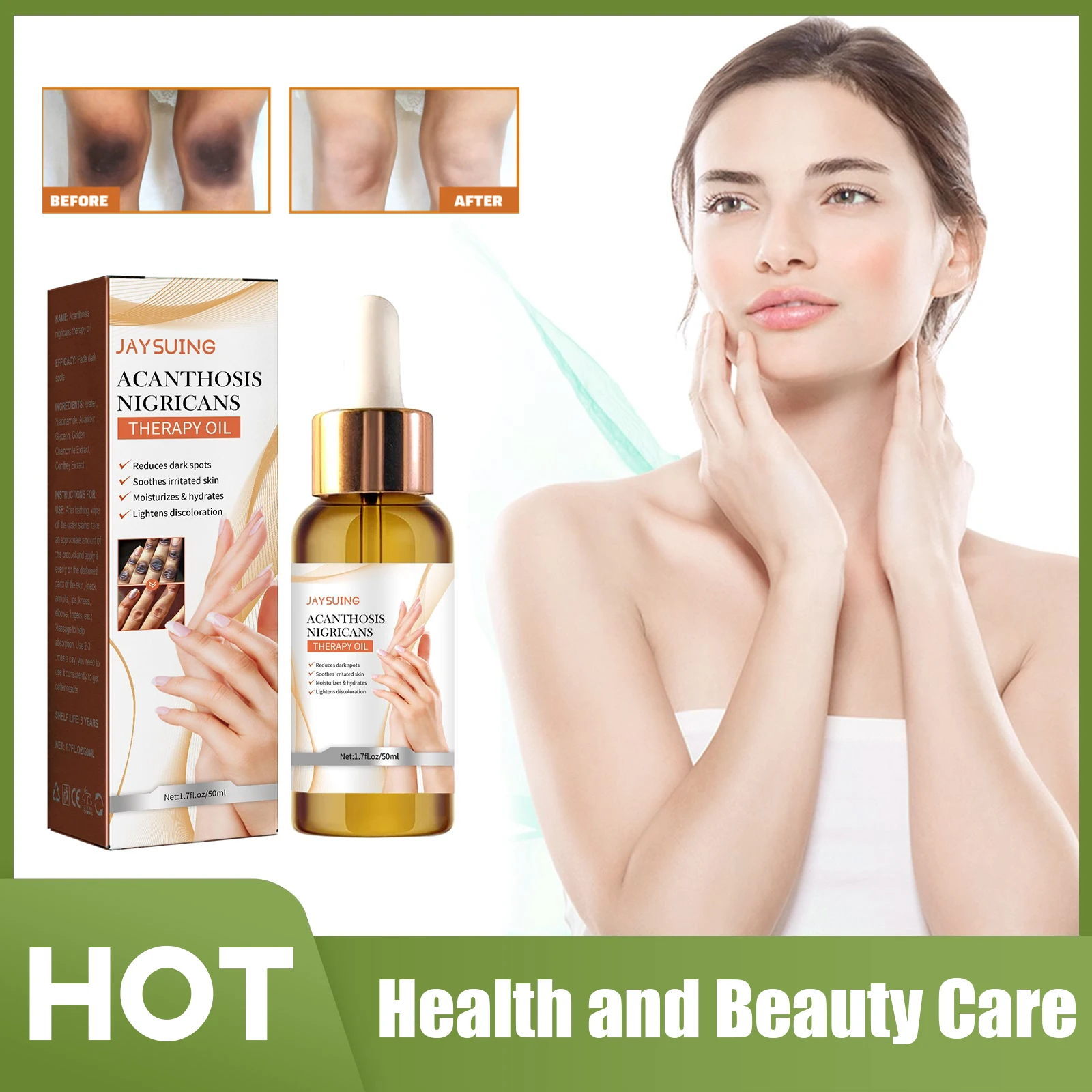 

Acanthosis Nigricans Therapy Oil Dark Spot Corrector Bleaching Underarm Arm Knee Removing Dark Knuckle Melanin Whitening Serum