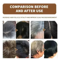 Sérum de traitement pour cheveux gris et blancs, couverture de cheveux blancs au noir, document naturel, spray de réparation, anti-perte, restauration de cheveux, soins capillaires sains 4
